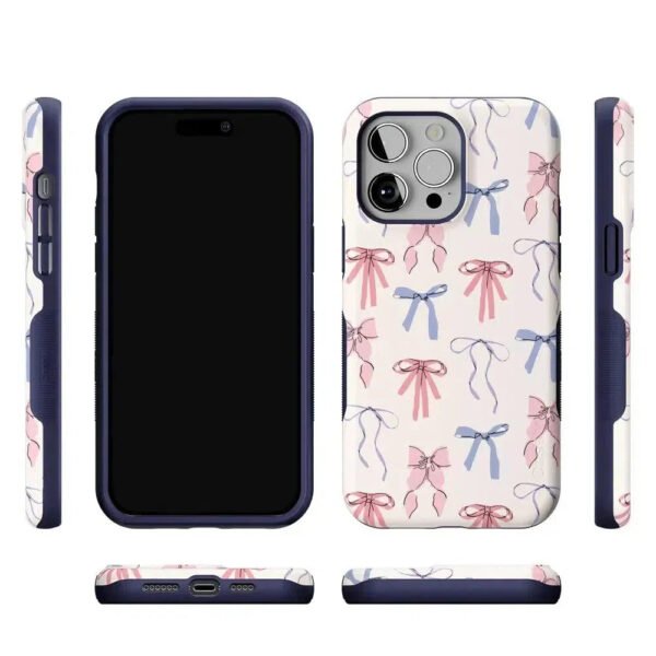 Coquette Girlie | Pastel Bows Case